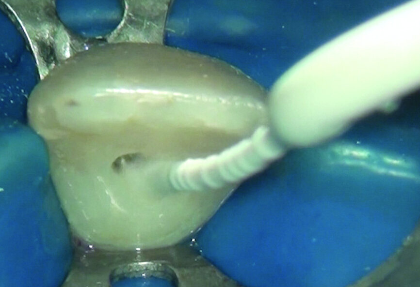 Fig.4: EDDY in action.