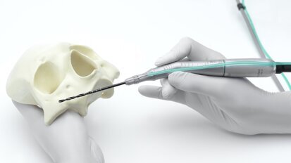 Una solución única para implantes cigomáticos