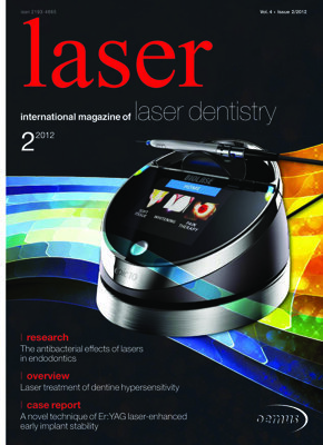 laser international No. 2, 2012 laser international No. 2, 2012