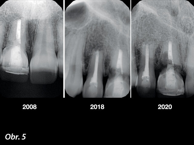 Výchozí rentgenové snímky.