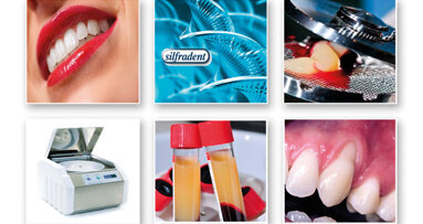 Workshop Silfradent: Concentrated Growth Factors (CGF) nella rigenerazione ossea e tessutale, aumenti di cresta orizzontali e verticali