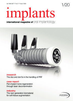 implants international No. 1, 2020 implants international No. 1, 2020