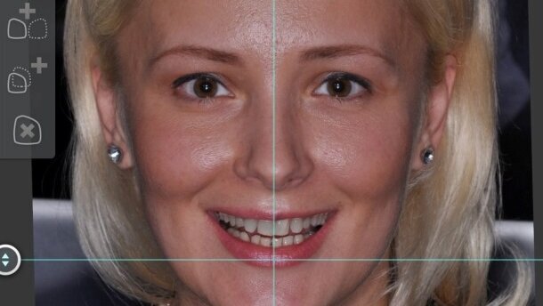 Technologia z Brazylii stworzy symetryczne uśmiechy