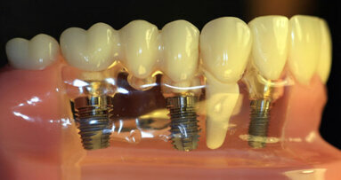 Η αποτυχία των εμφυτευμάτων μπορεί να σχετίζεται με τη χρήση διφωσφονικών