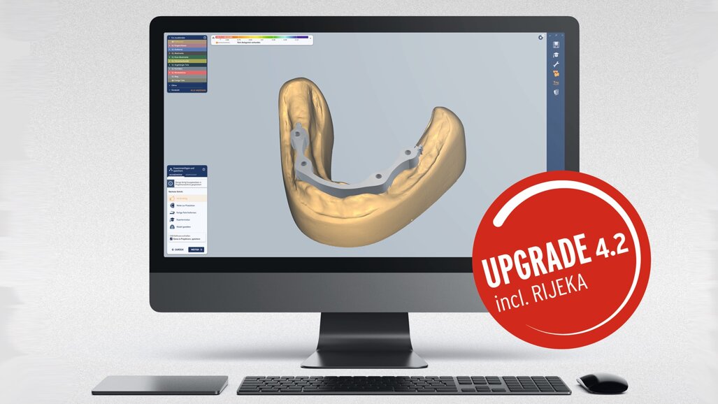 El mecanizado de restauraciones llega a un nuevo nivel