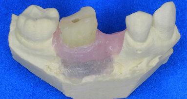 La tecnología y las técnicas tradicionales