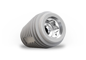 Keystone Dental Group – TiLobe Connection