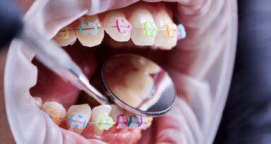 SPÖ-Bundesländer blockieren Neuregelung der Kieferorthopädie