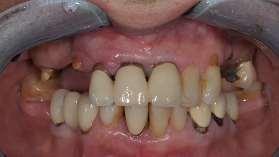 Obr. 1: Intraorální snímek.
