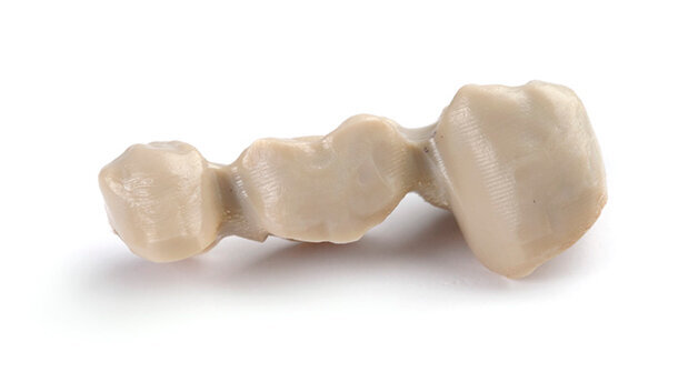 Protesi dentale premium non metallica: Juvora approvata per corone e ponti dentali