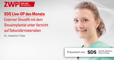 1 CME-Punkt: SDS Live-OP mit Dr. Josephine Tietje im Archiv abrufbar