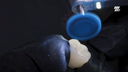 COLTENE – KENDA All Ceramic – 3-Step diamond polishing system