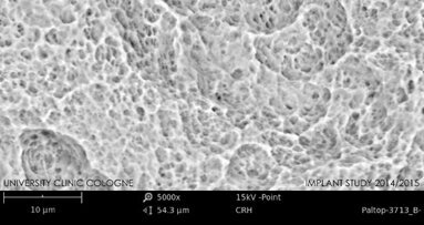 Impianti dentali privi di impurità sono essenziali per il successo clinico