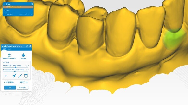 Valutazione CAD dei cambiamenti dimensionali dopo l’utilizzo di matrici in collagene