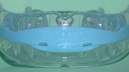 Myobrace: riflessioni, metodi di applicazione e caso clinico