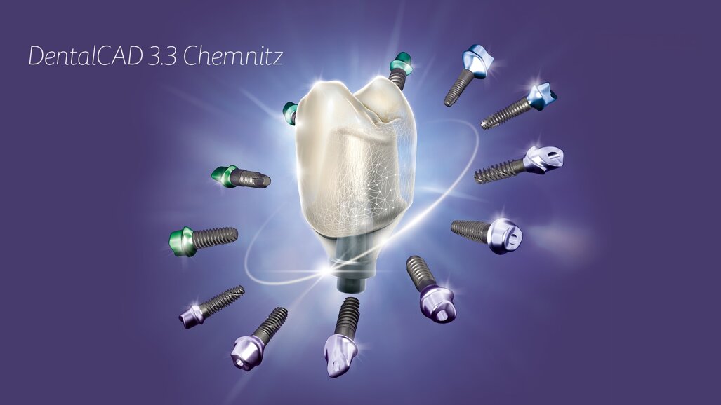 Neues Software-Release: exocad bringt DentalCAD 3.3 Chemnitz auf den Markt