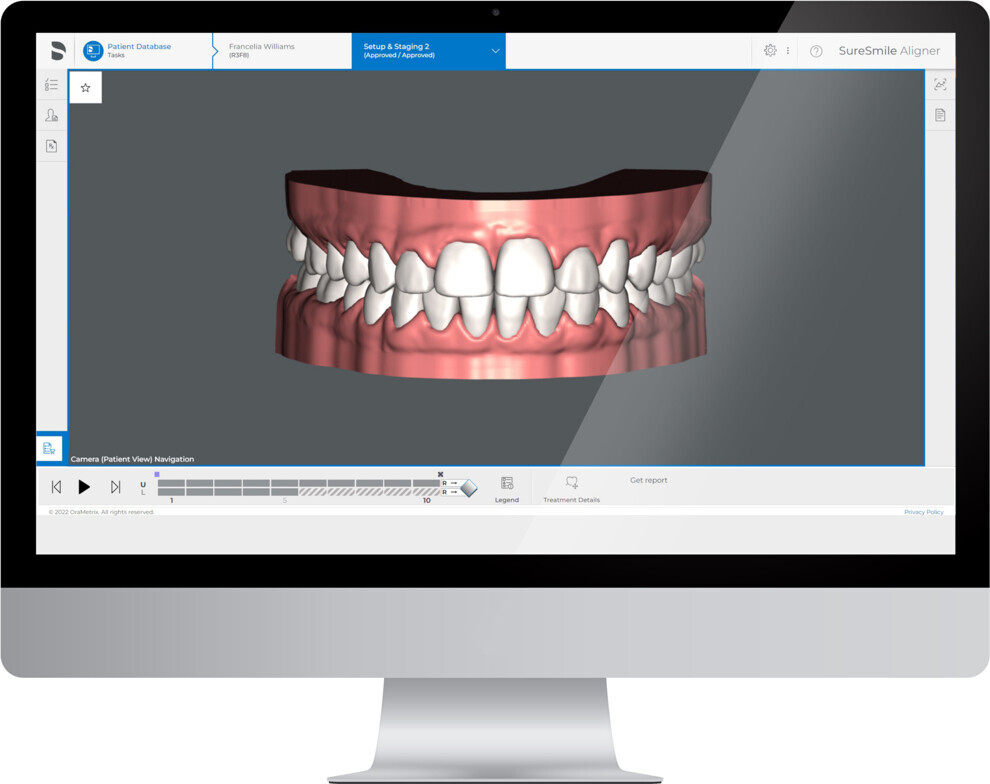 Fig. 4: Effective and predictable SureSmile treatment plans start with a high-quality digital impression.