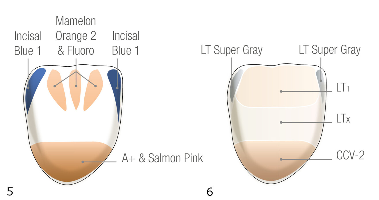 Fig. 5 : Schéma de la stratification pour la coloration interne des restaurations.
