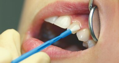 Un barniz con sabor a piña colada