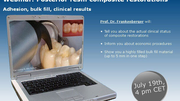 KaVo webinar  ‘Composiet vulsysteem voor posterieure restauraties’