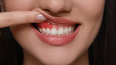 Mundgesundheit und Gehirn: Studie zeigt überraschende Zusammenhänge