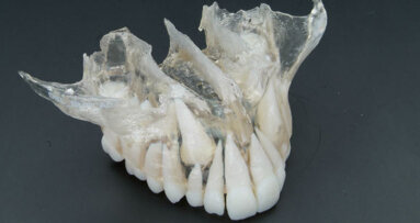 Il nuovo servizio Digital Dentistry della Leone S.p.A