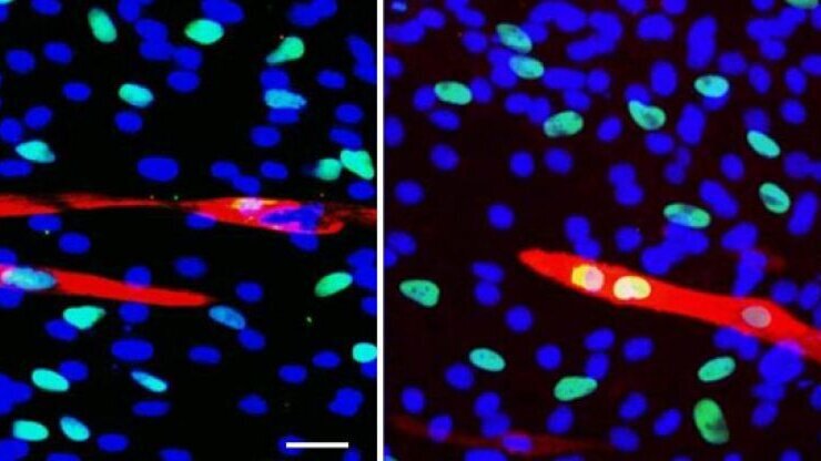 Les dentistes récoltent des cellules souches pour la médecine régénérative de l'avenir