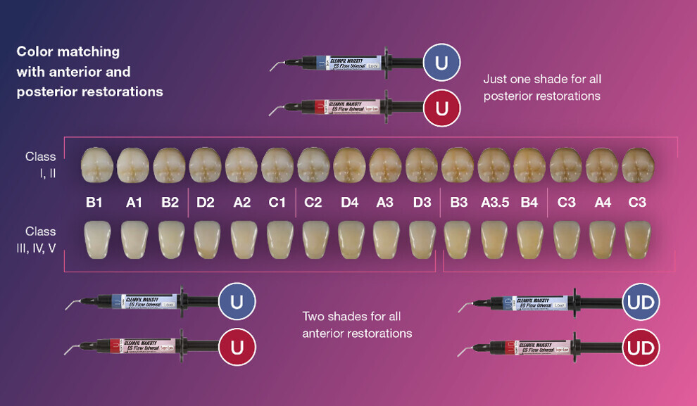 Ideal shade matching capabilities enable simplified selection from the two complementary shades Universal (U) and Universal Dark (UD).