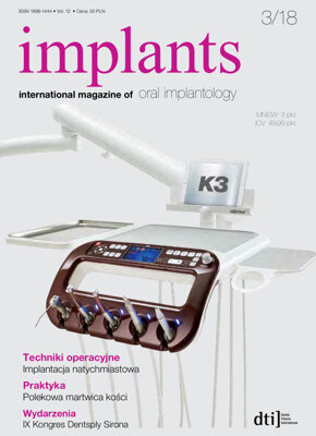 implants Poland No. 3, 2018 implants Poland No. 3, 2018