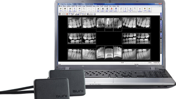 Digital X-ray sensor achieves lowest radiation exposure levels