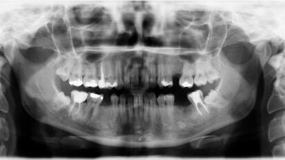 Kurs ochrony radiologicznej typu S dla lekarzy i lekarzy dentystów
