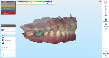 Disruptive digital tools: How technology is changing dentistry