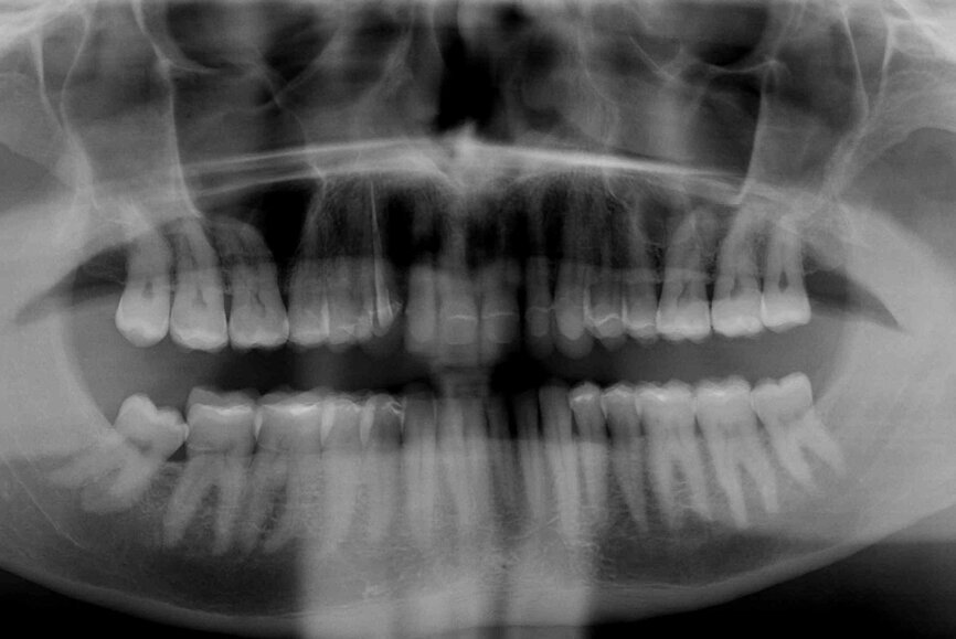 Fig. 15: Panoramic image at the end of treatment.