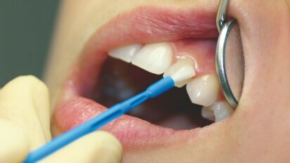 Un barniz con sabor a piña colada