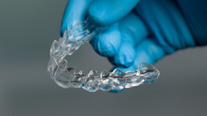 Report details adhesive-free bonding of metal buttons to aligners