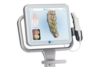 Align Technology - iTero intra-oral scanners