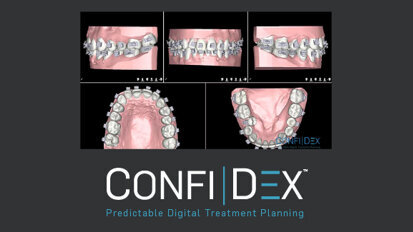 Six Month Smiles seeks global partners