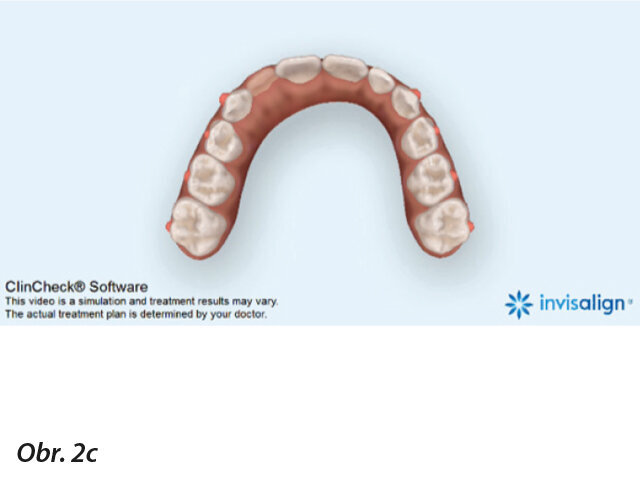 Expanze oblouku je dokončena (c).