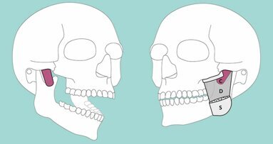 Neue Muskelschicht am Kiefer entdeckt
