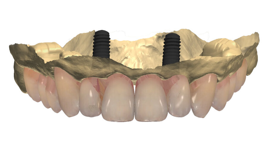 Fig. 35_Sovrapposizione di un’immagine stilizzata degli elementi realizzabili con un margine muso ricreato.