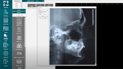 Polorto – Ortonet – Performing Cephalometry