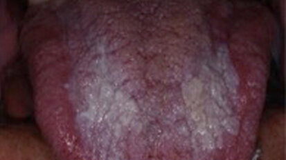 Un’App gratuita per aiutare a orientarsi nella diagnosi morfologica delle lesioni del cavo orale