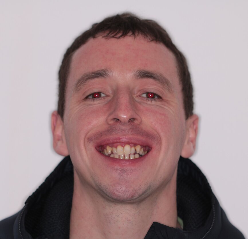 Fig. 1: Pre treatment