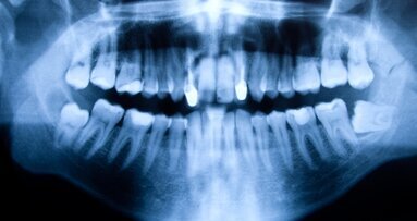 Baldiger Ersatz für Röntgenstrahlen?