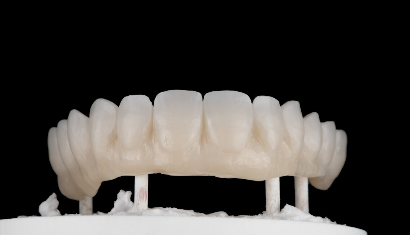 Fig. 8: Zirconia framework after sintering.