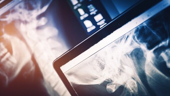 Dangerous X-ray radiation: German authorities caution Asian IDS exhibitors