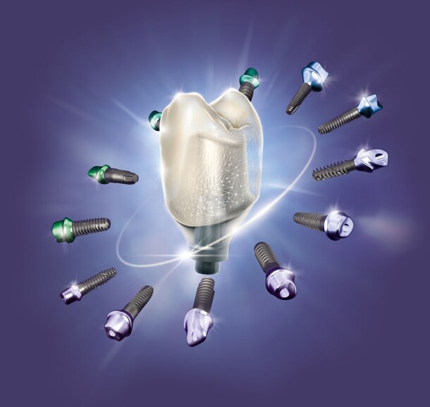 exocad – DentalCAD