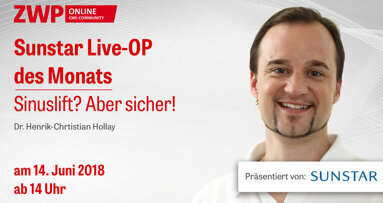 Sunstar Live-OP: Sinuslift? Aber sicher!