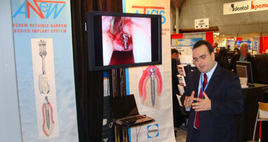 Dentatus makes implants attainable to new populations