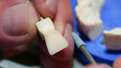 Meisterzwang für Zahntechniker vom Oberverwaltungsgericht bestätigt Meisterzwang für Zahntechniker vom Oberverwaltungsgericht bestätigt